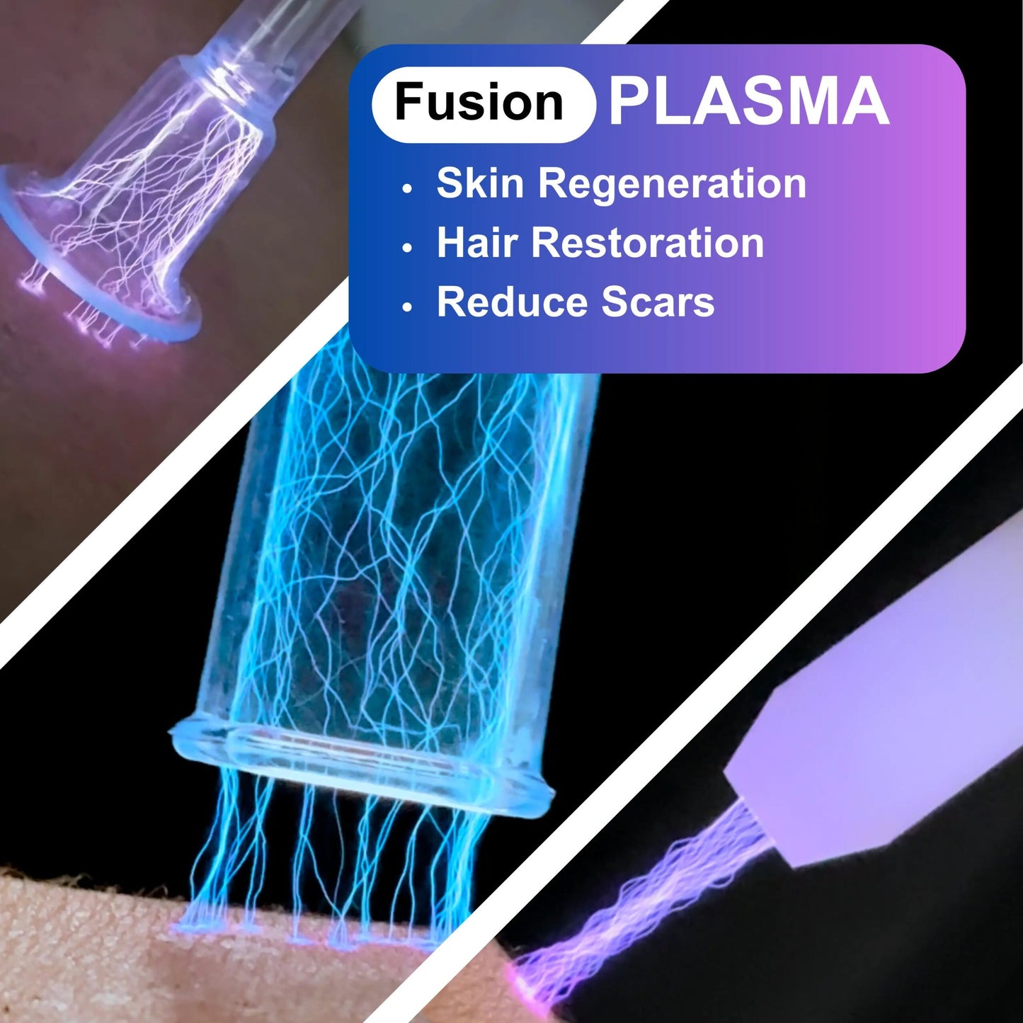 Newest Fusion Cold Warm Plasma