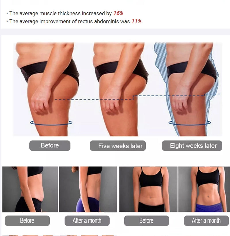 Portable 4 Handles EMS Body Sculpt Body Contouring Slimming Device