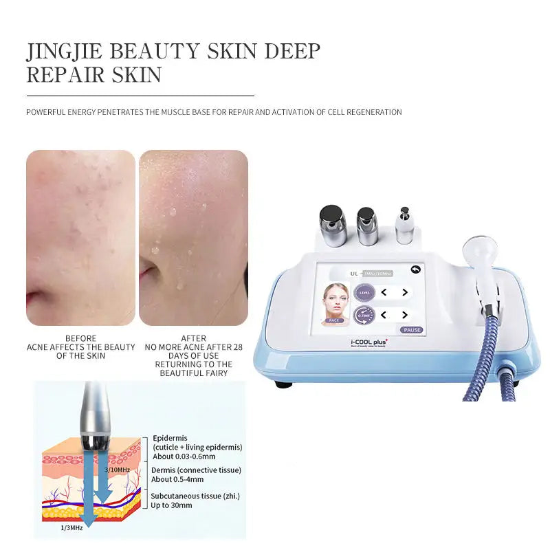 ICOOL PLUS SONIC ULTRASONIC PRODUCT PENERATION DEPTH Product image 6