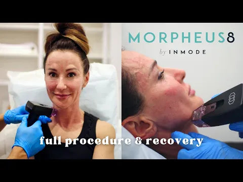 Portable 2 In 1 Morpheus8 Machine Skin Lifting Anti-aging Freckle Wrinkle Removal Acne Treatment Fractional Salon Use Device image 5