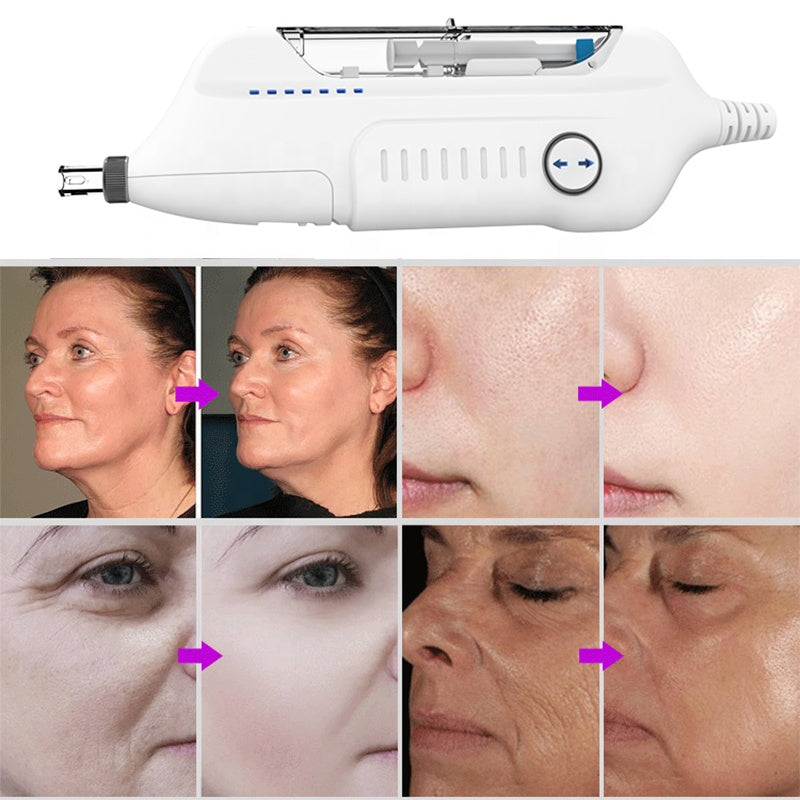 Facial Care Nutrition Face Lightening Rejuvenation Hy-Dra-Skinboosters Meso Gun