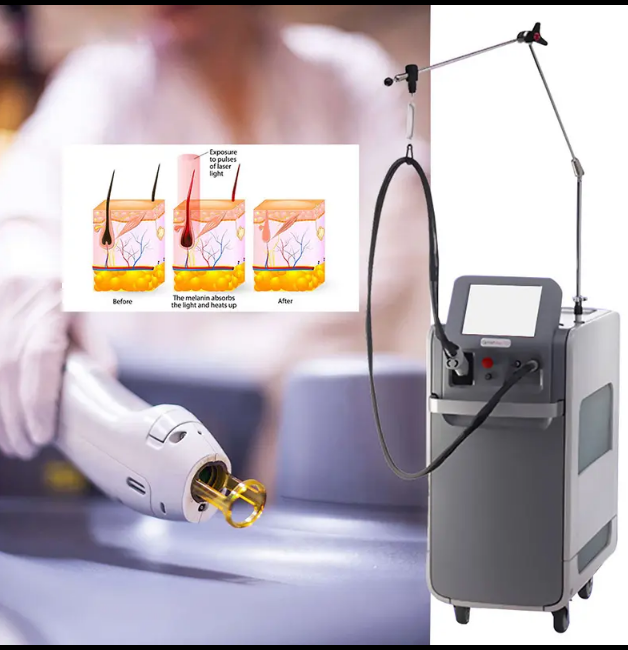 New CANDELA GentleMax Pro