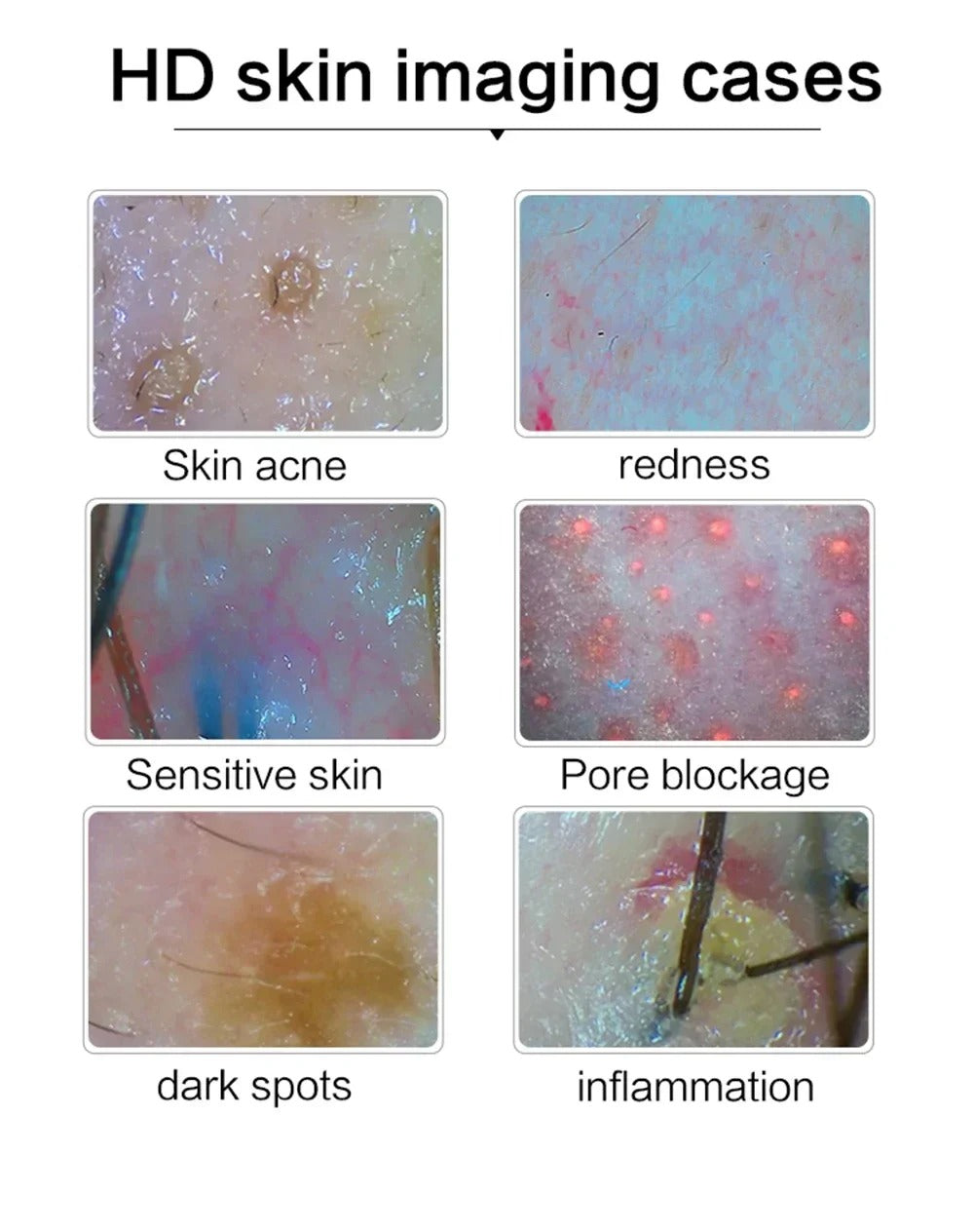HD Digital Skin Analyzer Professional Hair Scalp Camera Detector Hair Follicle Oil Moisture Test Device 15inch Skin Tester image 2