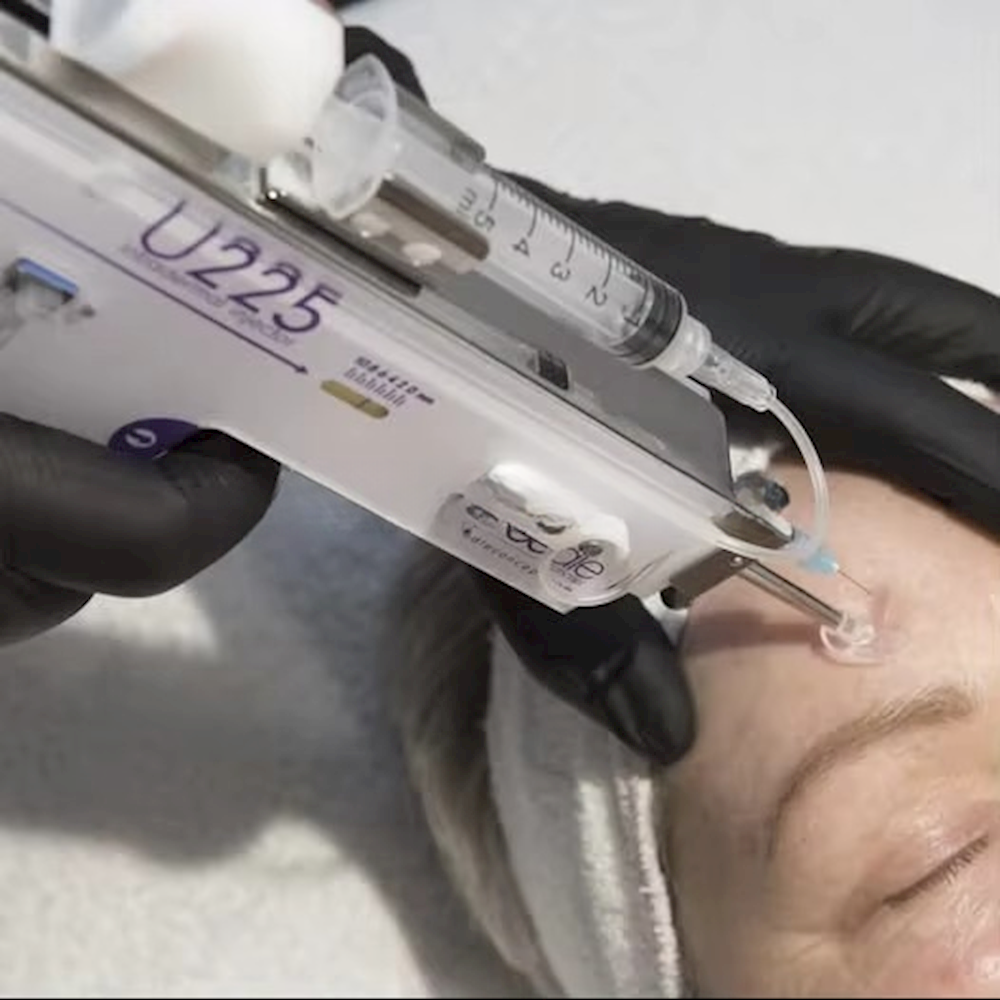 Mesotherapy Gun Needle Injection Gun Prp Mesotherapy Injection Gun Needleless Anti-aging Nano Crystal U225meso